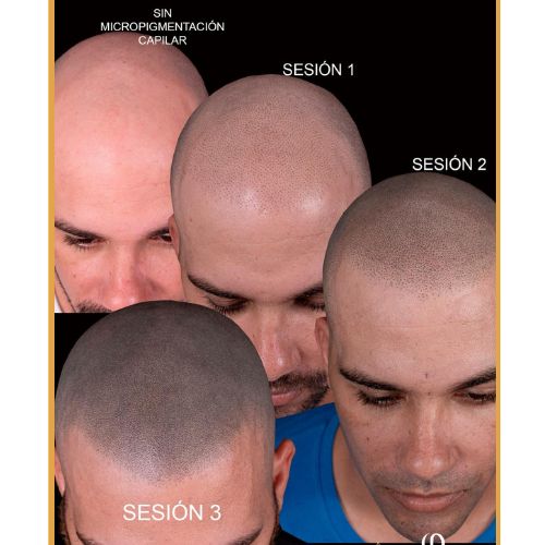 diseño sin título 2026 03 17t162553.568